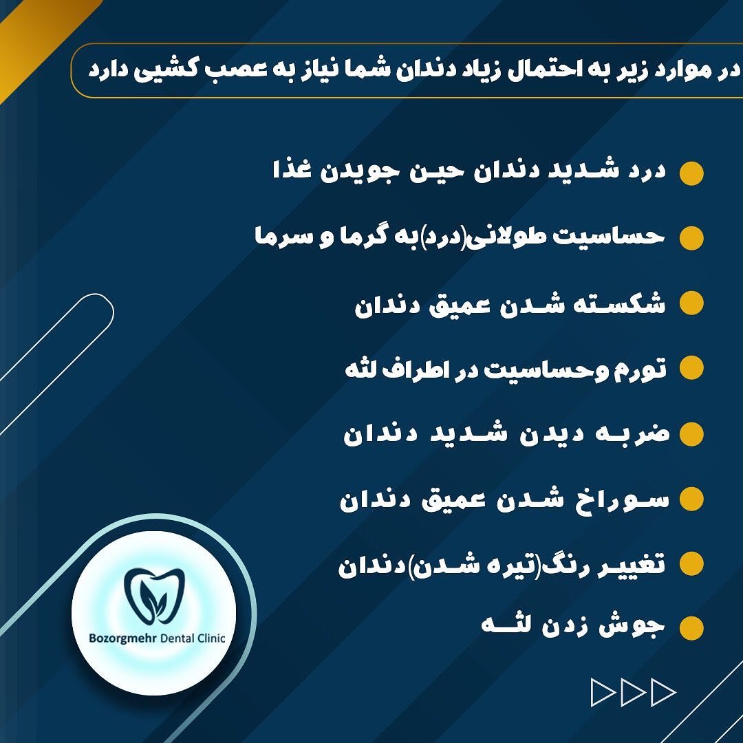 عصب کشی دندان مشهد