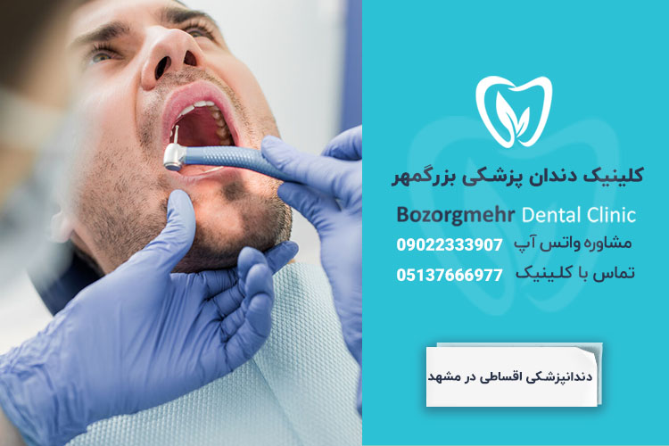 دندانپزشکی اقساطی در مشهد