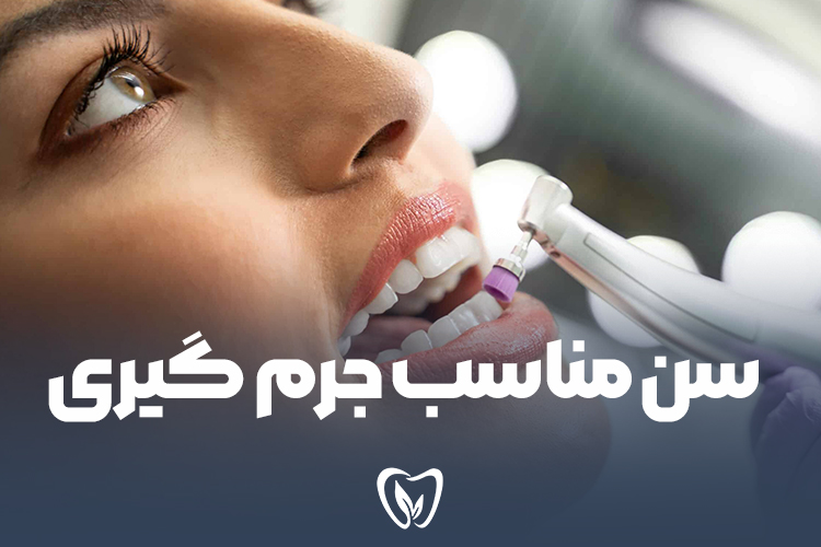 سن مناسب جرم گیری دندان