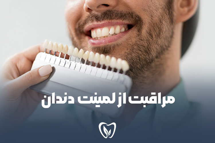 مراقبت از لمینت دندان